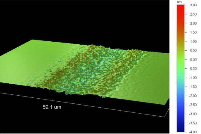 WIERCENIE LASEROWE MICROVIA (8)