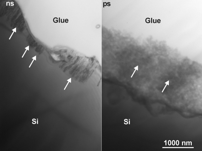 WIERCENIE LASEROWE MICROVIA (11)