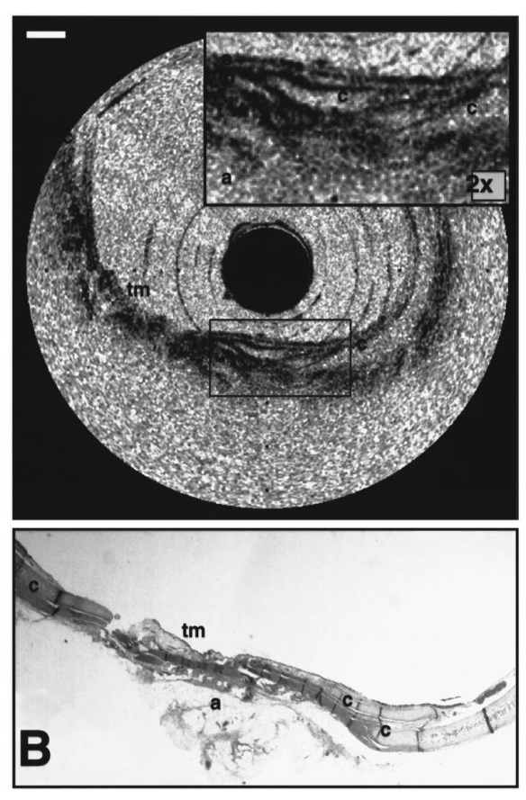 Technologia laserowa (3)