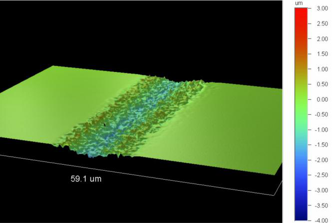 WIERCENIE LASEROWE MICROVIA (7)