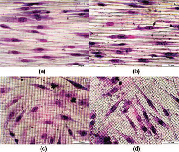 Zastosowania lasera (5)